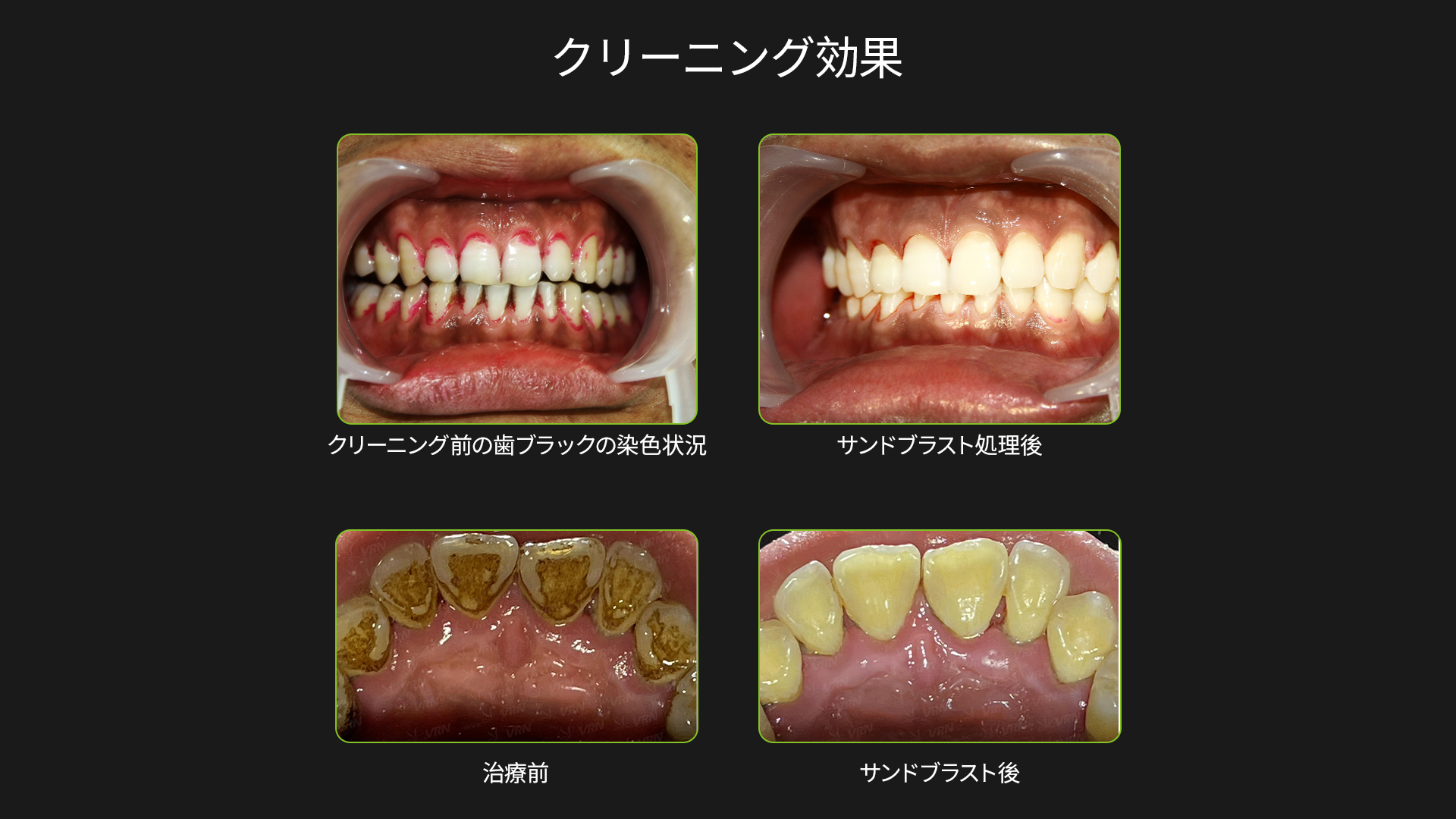 畫(huà)板 12.jpg